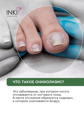 INKI   Лосьон профилактический для ногтей №2   СТОП ОНИХОЛИЗИС   30мл