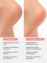 MANITA Крем для ног С МОЧЕВИНОЙ 12% 500мл {7724}