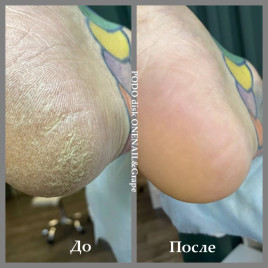 ONE NAIL &amp; GRAPE   Сменные файлы педикюрные 50шт.   15мм   #180   Limited