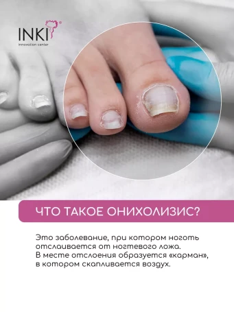 INKI   Масло для ногтей   СТОП ОНИХОЛИЗИС   30мл