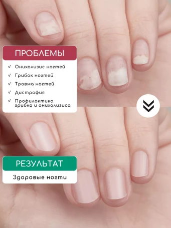 INKI   Масло для ногтей   СТОП ОНИХОЛИЗИС   30мл