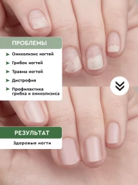 INKI Бальзам регенерирующий для ногтей СТОП ОНИХОЛИЗИСс 10мл